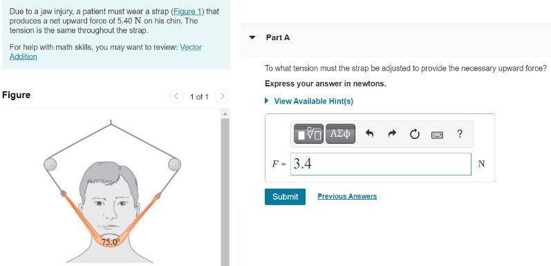 Due to a jaw injury, a patient must wear a strap (Figure 1) that produces a net upward force of 5.40 N on his chin. The tension is the same throughout the strap. For help with math skills, you may want to review: Vector Addition Figure 1 of 1 Part A To what tension must the strap be adjusted to provide the necessary upward force? Express your answer in newtons. View Available Hint(s) F = N Submit Previous Answers