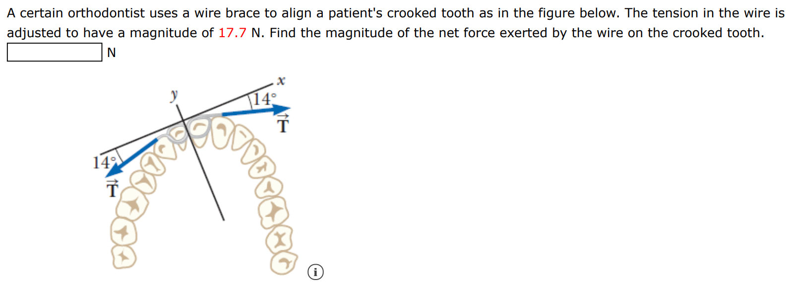 A certain orthodontist uses a wire brace to align a patient's crooked tooth as in the figure below. The tension in the wire is adjusted to have a magnitude of 17.7 N. Find the magnitude of the net force exerted by the wire on the crooked tooth. N 